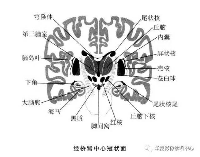 【影像基础】值得收藏的基底节及周围区域解剖详图