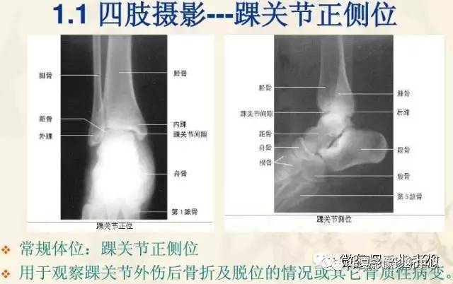 史上最实用全身各部位各体位x线片摄影要点