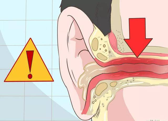 耳垢可以清理出来,但清理时应注意不要损伤到耳朵里面的敏感部位.