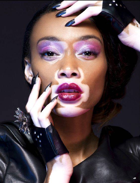 "奶牛超模":winnie harlow