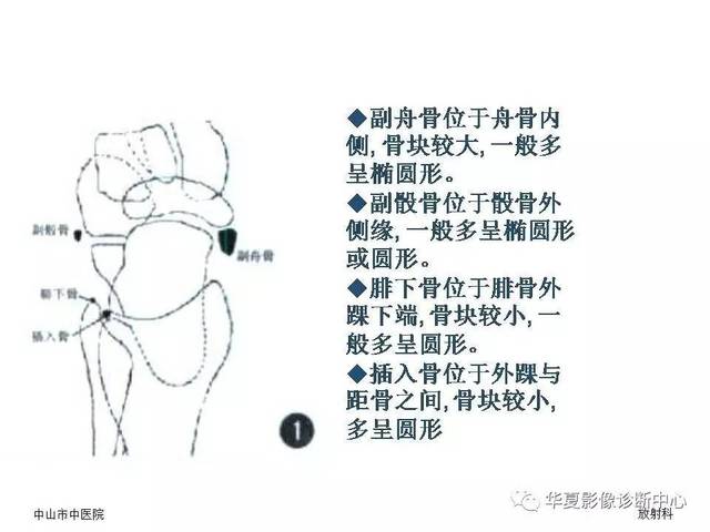 籽骨副骨及永存骨骺请别再误诊