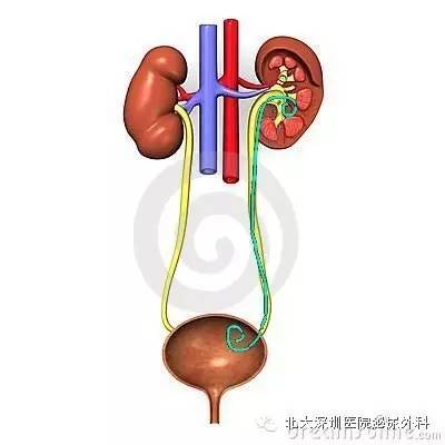 放置部位:双j管两个勾,一端是勾在肾盂,另一端是勾在膀胱.