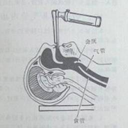 气管插管之必备技能_手机搜狐网