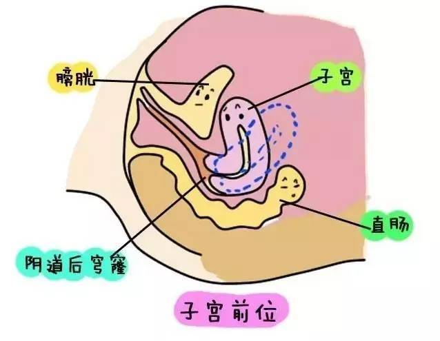 子宫前位是指子宫体向肚皮的方向倾倒.