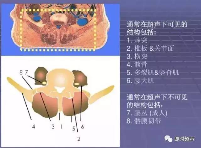 超声引导下椎旁神经阻滞——腰丛