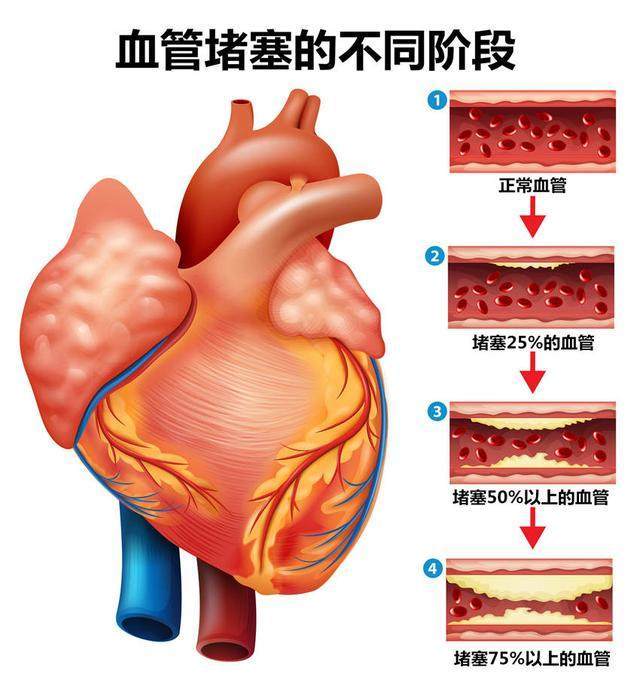 食物界公认的血管清道夫,血液净化剂