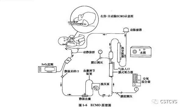 ecmo的基本结构包括血管内插管,连接管,动力泵(人工心脏),氧合器