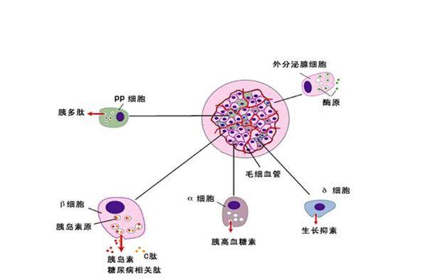 长期使用胰岛素2型糖尿病就会变成1型?