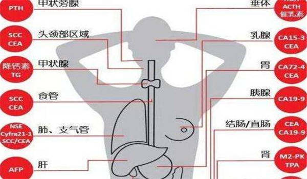 一管血查20种癌有望成为可能