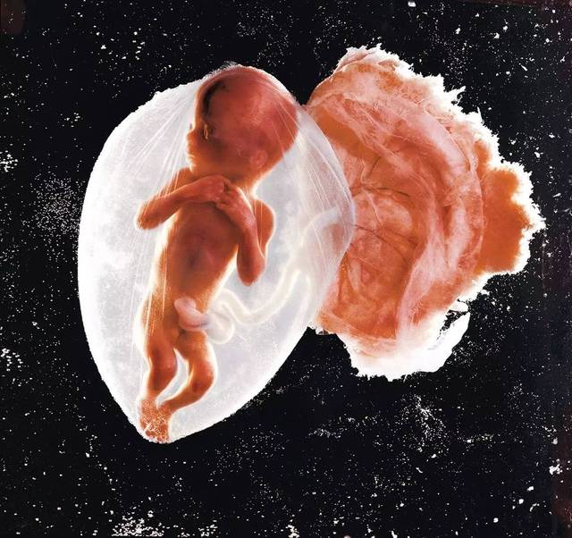 借助内窥镜与扫描电子显微镜技术拍摄的十八周胎儿子宫发育的照片