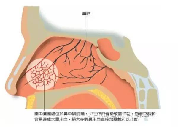 爱鼻日春天孩子易出鼻血怎么办