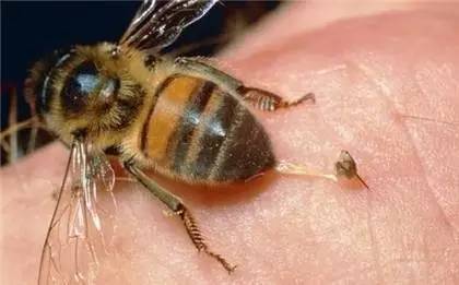 被蜜蜂蜇伤了,又痛又肿,紧急情况下你需要自救!