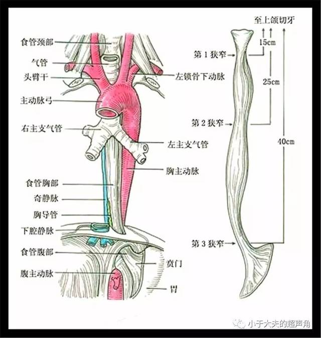 【超声】颈段食管癌【病例分享】