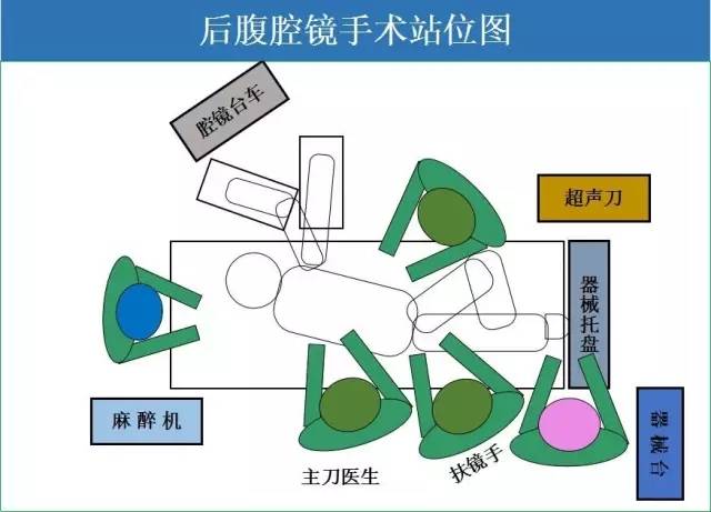 最形象的手术室站位图 做不对你就out啦!