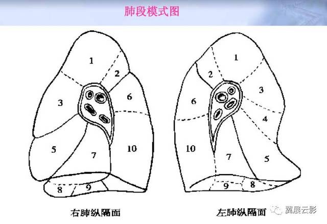 正常胸部ct肺段及淋巴结分区