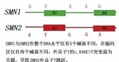 脊髓性肌萎缩症(sma)与基因检测 专题