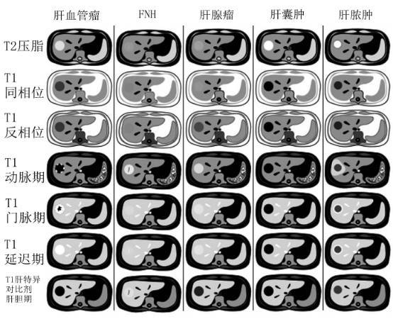 大家一起来学习 肝脏占位mri