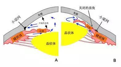 房水循环示意图