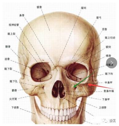 这里看下上颌骨的位置.和颧骨,鼻骨相接.就