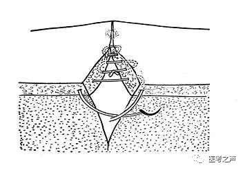 图文并茂:详解各种外科缝合法