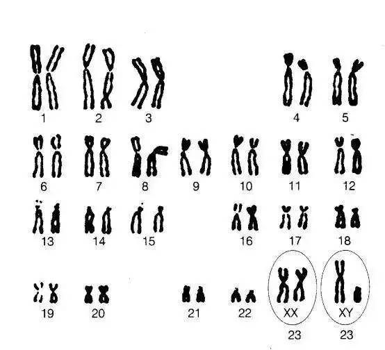 【11个经典案例】解读人类染色体核型分析报告