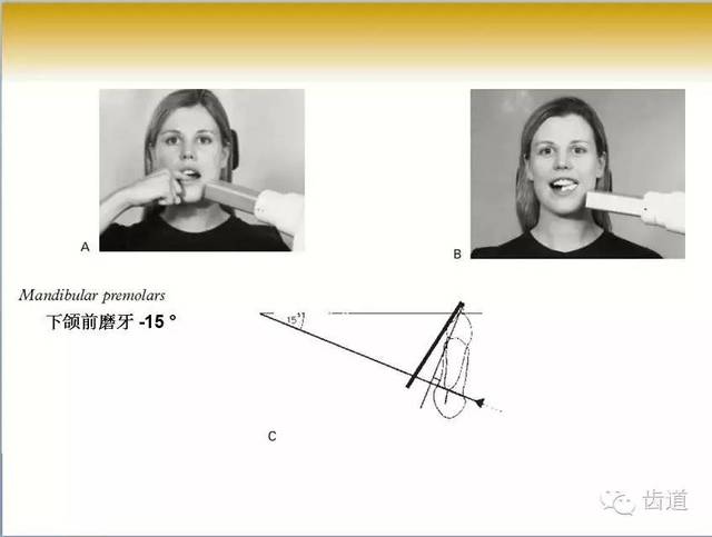 牙医必藏:各类牙齿的牙片拍摄定位方法大全