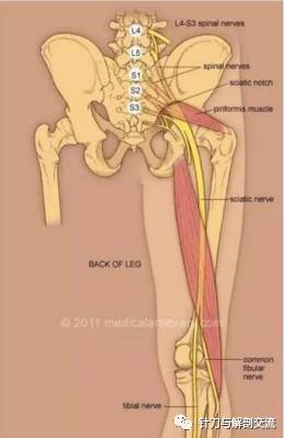 致易发生损伤性炎性改变,刺激或压迫神经,而产生腰腿痛 坐骨神经损伤