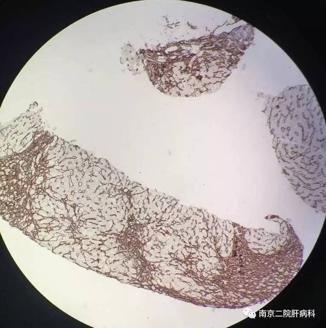 一招教你用手机拍出高质量显微镜下图片