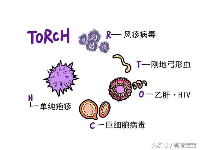 torch检查:torch是弓形虫,风疹病毒,巨细胞病毒,单纯疱疹病毒的首字母