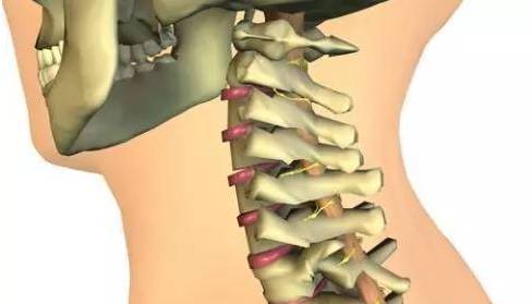 颈椎病人口_颈椎病的症状图片(3)