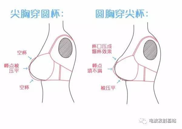 从侧面看,圆锥型上半球比较平直,下半球饱满,乳房是尖尖的往上翘的