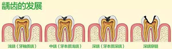 跟奶粉有关系吗?