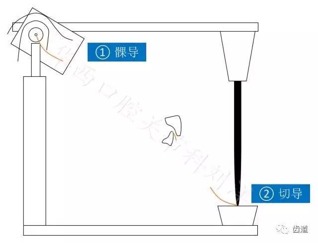 相应地, he架上就对应于 髁导和 切导