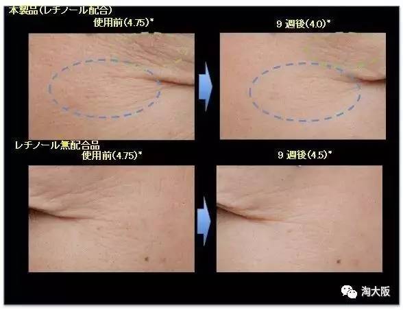 日本第二支获认证的资生堂抗皱眼霜叫嚣pola,目标是在半年卖100万支!