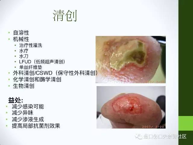 课件来源:本课件译自国际伤口感染学会(international wound