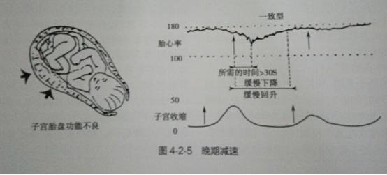 变异减速(图七)