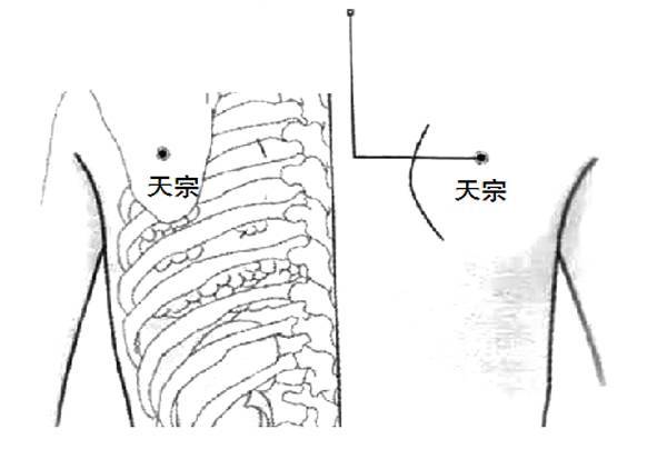 肩胛疼痛手臂麻木?让人帮您按按天宗穴