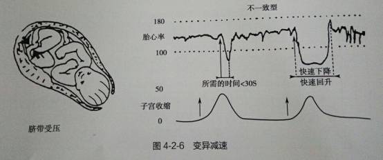 变异减速(图八)