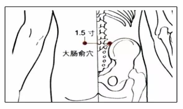 (1)肾俞,腰阳关,大肠俞,关元俞: 取艾条1根,点燃后悬于各穴位之上,艾