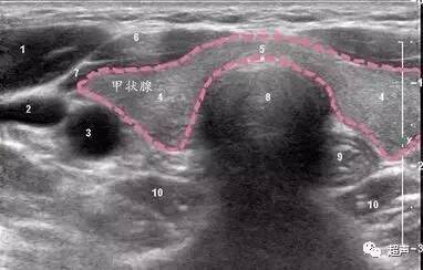 看懂甲状腺超声不难