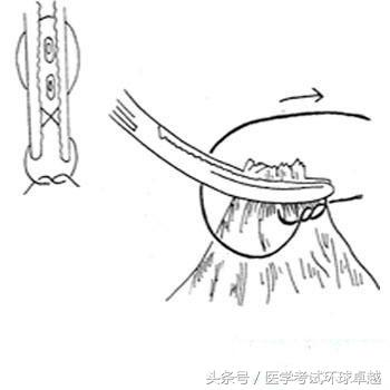 四,缝合 1,缝针 三角针:用于缝合皮肤,肌腱等坚韧组织 圆针:用