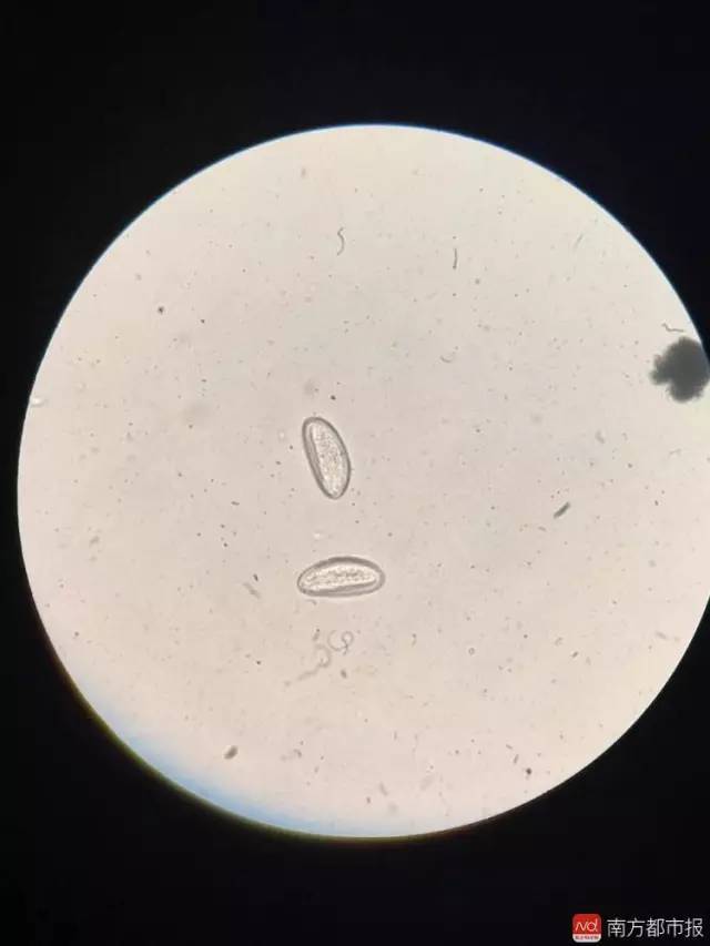 显微镜下的蛲虫虫卵