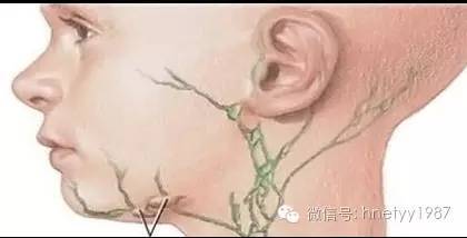 浅表淋巴结主要分布于耳前,耳后,乳突区,枕下,颈前,颈后,颌下颏下