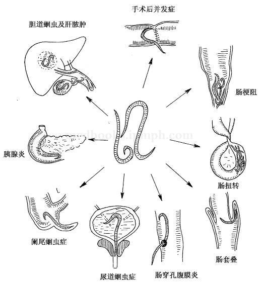 儿童非常容易感染蛔虫病,后果很严重!宝贝爸妈要警惕!