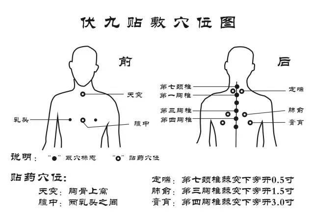 创造性地提出了冬季"三九"与夏季"三伏"天相结合的中药穴位贴敷疗法