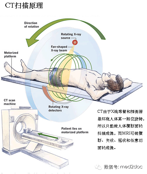 一图读懂ct和mri的扫描原理和适应症