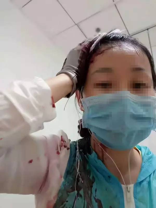 北沙梁白云路一女子骑电车莫名被一男子砍了四刀,伤势严重,全城搜索