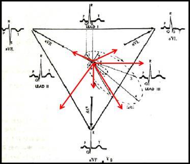 心电图图形是有瞬间心电向量在相应导连轴上的投影描记而成.