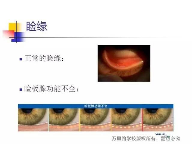 【微课堂】如何利用裂隙灯进行眼部健康状态的检查?(下)