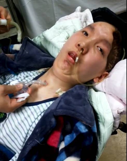 濮阳13岁少年遭遇无情车祸,大脑被切除四分之一,肇事者全家逃跑,全城